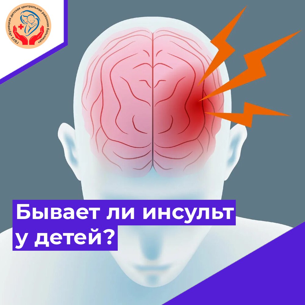 Бывает ли инсульт у детей? - ГБУЗ «Кузнецкая детская центральная районная  больница»